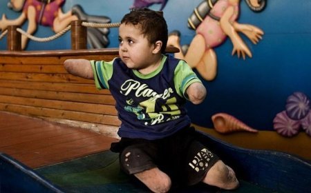 İsrail hərbi cinayətləri: Hər gün 30 qəzzalı əlil olur