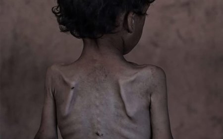 Qəzzada aclıq qurbanlarının sayı artır – SON STATİSTİKA