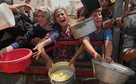 Qəzzada aclıqdan ölənlərin sayı 281-ə çatıb, 114-ü uşaqdır