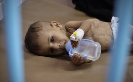 Qəzzada aclıqdan həyatını itirənlərin sayı 367-yə yüksəlib