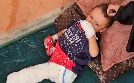 4 min qəzzalı uşağın əl-ayaqları amputasiya edilib