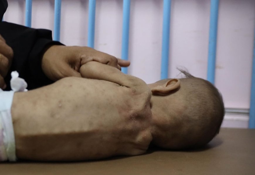 İsrail Fələstin xalqını bombalar və aclıqla qətliam edir