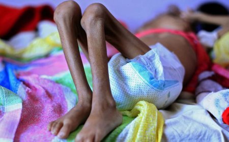 Dünyada aclıq çəkən insanların sayı