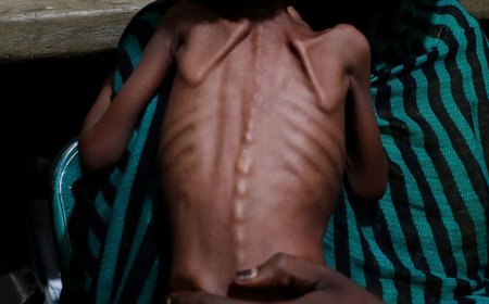 Sudanda 21 milyon insan aclıqdan əziyyət çəkir