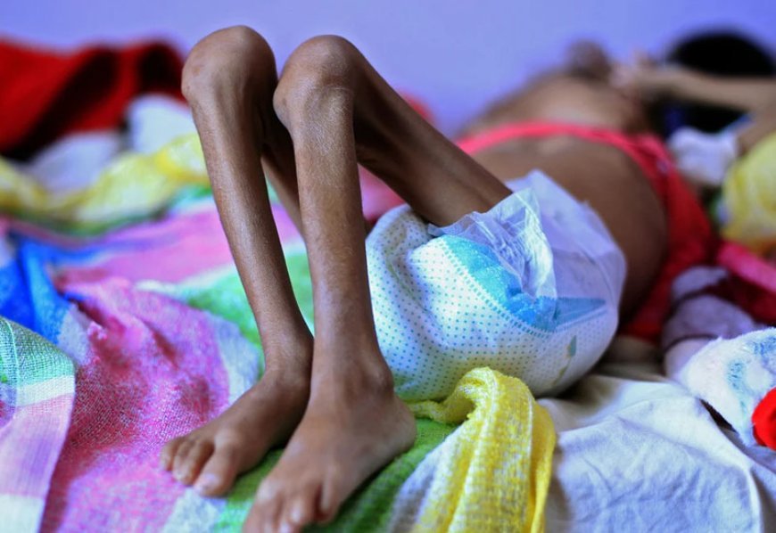 Dünyada aclıq çəkən insanların sayı