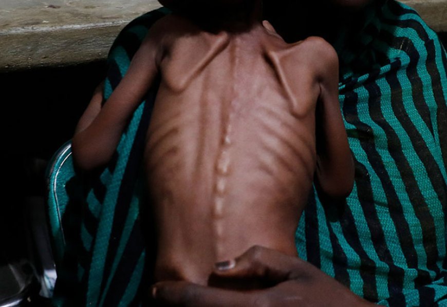 Sudanda 21 milyon insan aclıqdan əziyyət çəkir