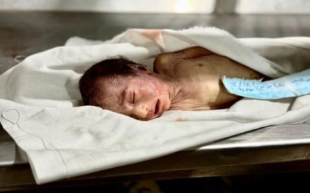 Son 48 saatda Qəzzada 12 şəhid və 7 yaralı