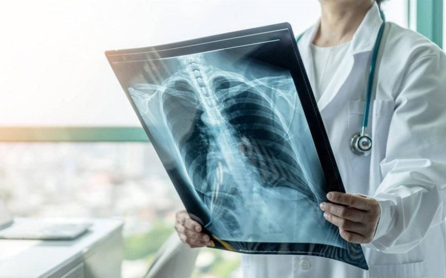 Ağciyər xərçənginin skrininqi proqramı tam maliyyələşdiriləcək