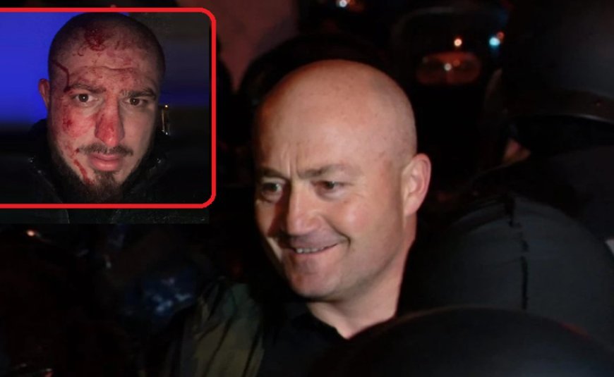 "Xareba" ittihamları rədd etdi: "Onun üzünə sadəcə qan sürtülüb"