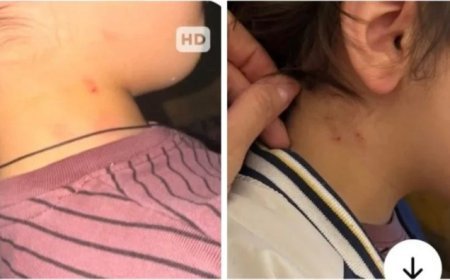 2 yaşlı uşağa qarşı zorakılıq skandalı: Bağça rəhbərliyindən təcili bəyanat