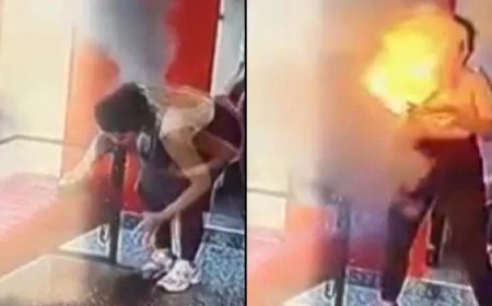 Çantasındakı “powerbank” partladı, xəsarət aldı - Video