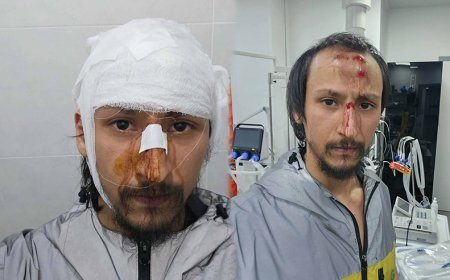 Tbilisidə "Glovo" kuryerinə hücum edən 3 nəfər tutuldu